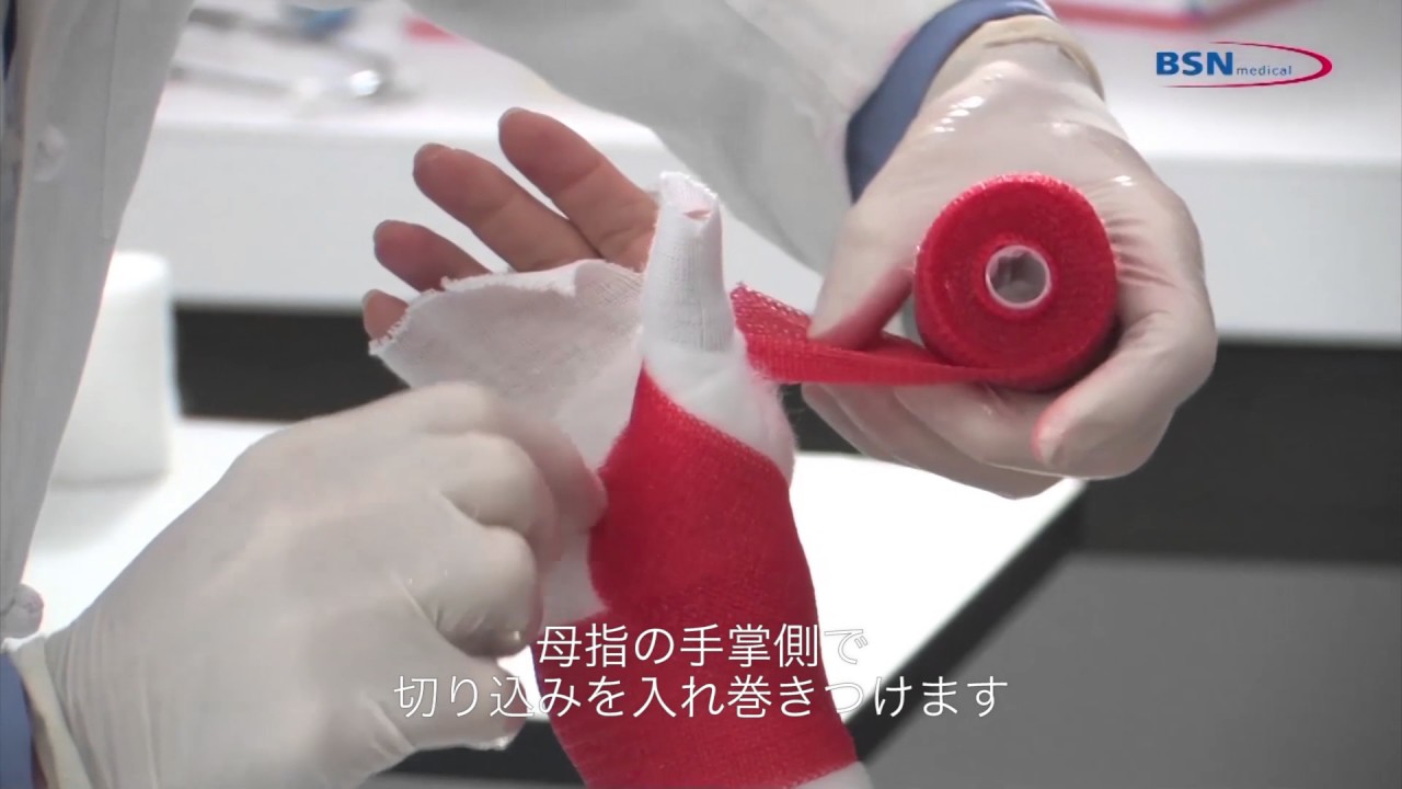 合成キャスト： BSN medicalによる母指CM関節の固定