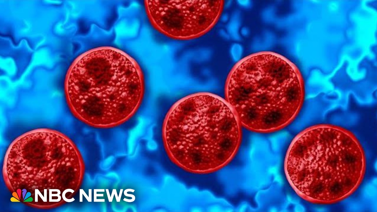 Michigan reports two deaths linked to cyclosporiasis outbreak