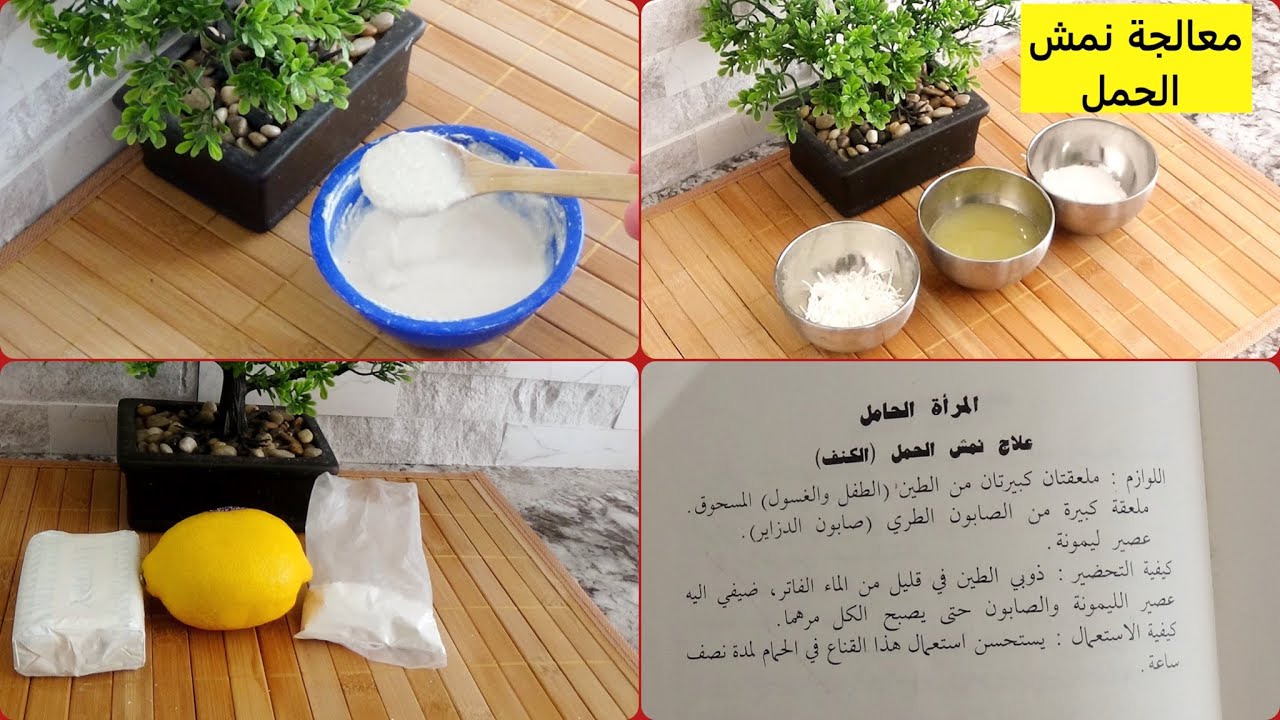 //DZ//أقوى وصفة مجربة للقضاء على نمش الحمل أو الكلف بمكونات بسيطة