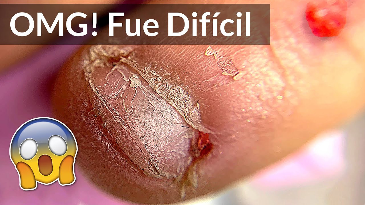 De Uñas Extremadamente Mordidas a Largas – Transformación con Manicure y Extensiones