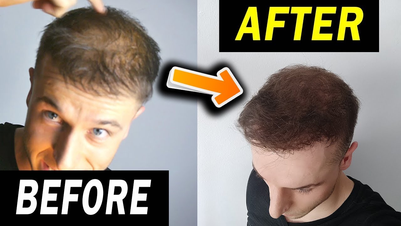 How To Use Hair Fibers for Thinning Hair? Gofybr