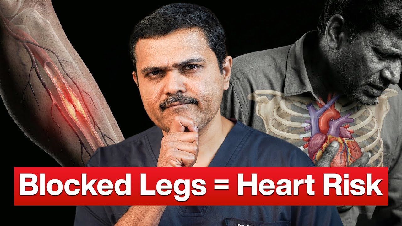The SURPIRSING Link Between Leg Pain and 5x Higher Heart Attack Risk