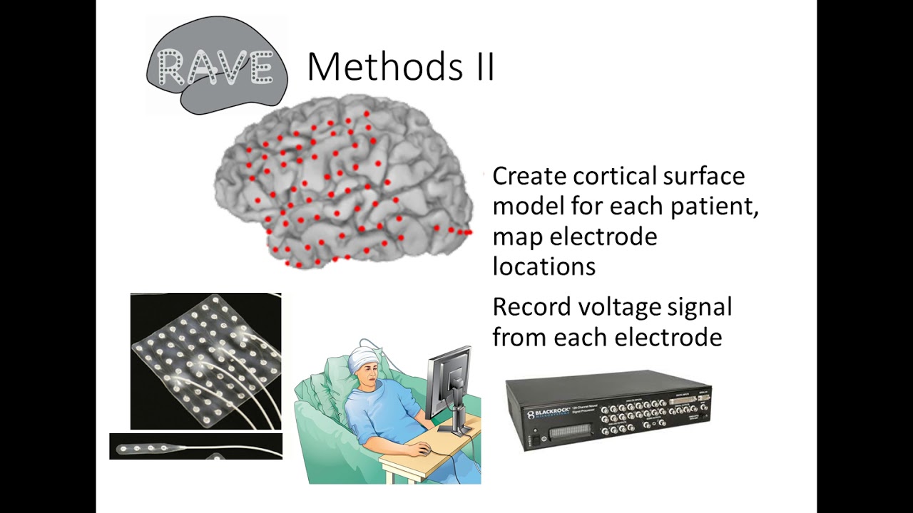 Innovative Neurotechnologies: RAVE: R Analysis and Visualization of Intracranial Encephalography