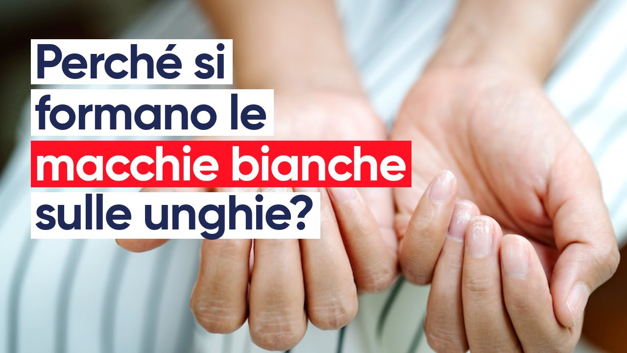 Perch&eacute; si formano le macchie bianche sulle unghie?