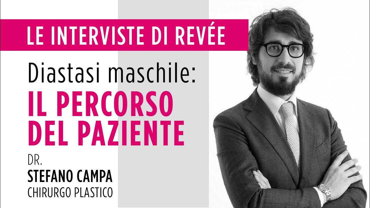Diastasi maschile: il percorso del paziente. Intervista al Dottor Stefano Campa