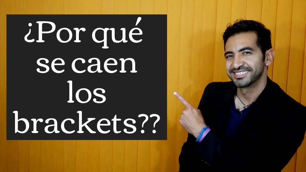 ¿Se te cayó un braket? Yo te explico por qué.