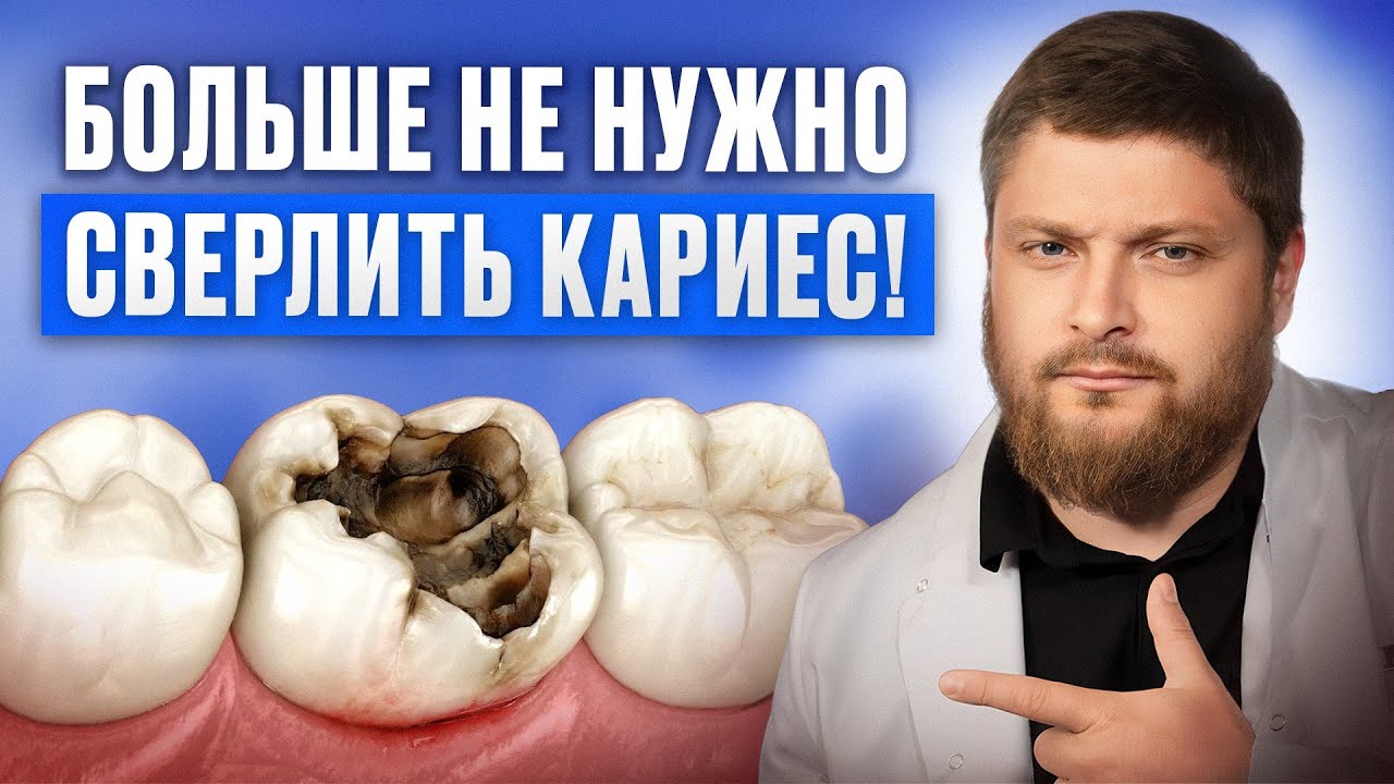 ЭТО ПРОРЫВ в лечении кариеса! В России УЖЕ НАЧАЛИ ставить вечные пломбы!