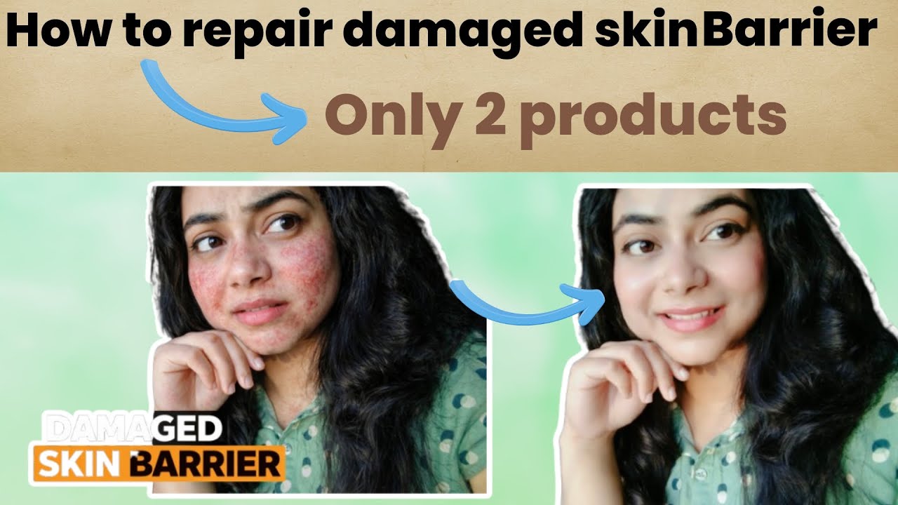 How to Repair Damaged Skin Barrier Fast (Step-by-Step Guide)