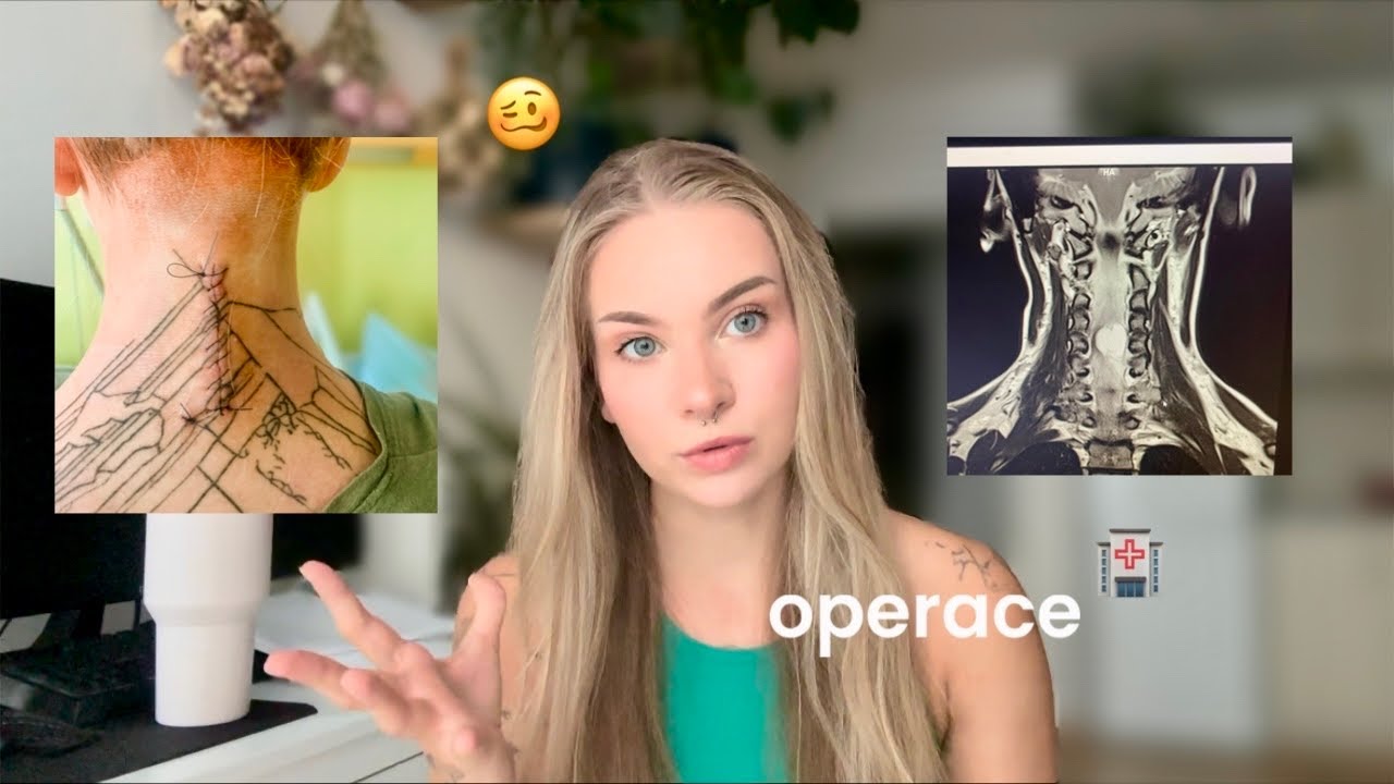 dvě operace páteře za dva roky // aneb jak jsem skoro ochrnula