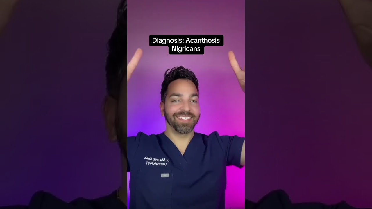 Do you have darker neck? This is acanthosis nigricans&hellip; you&rsquo;re not dirty!