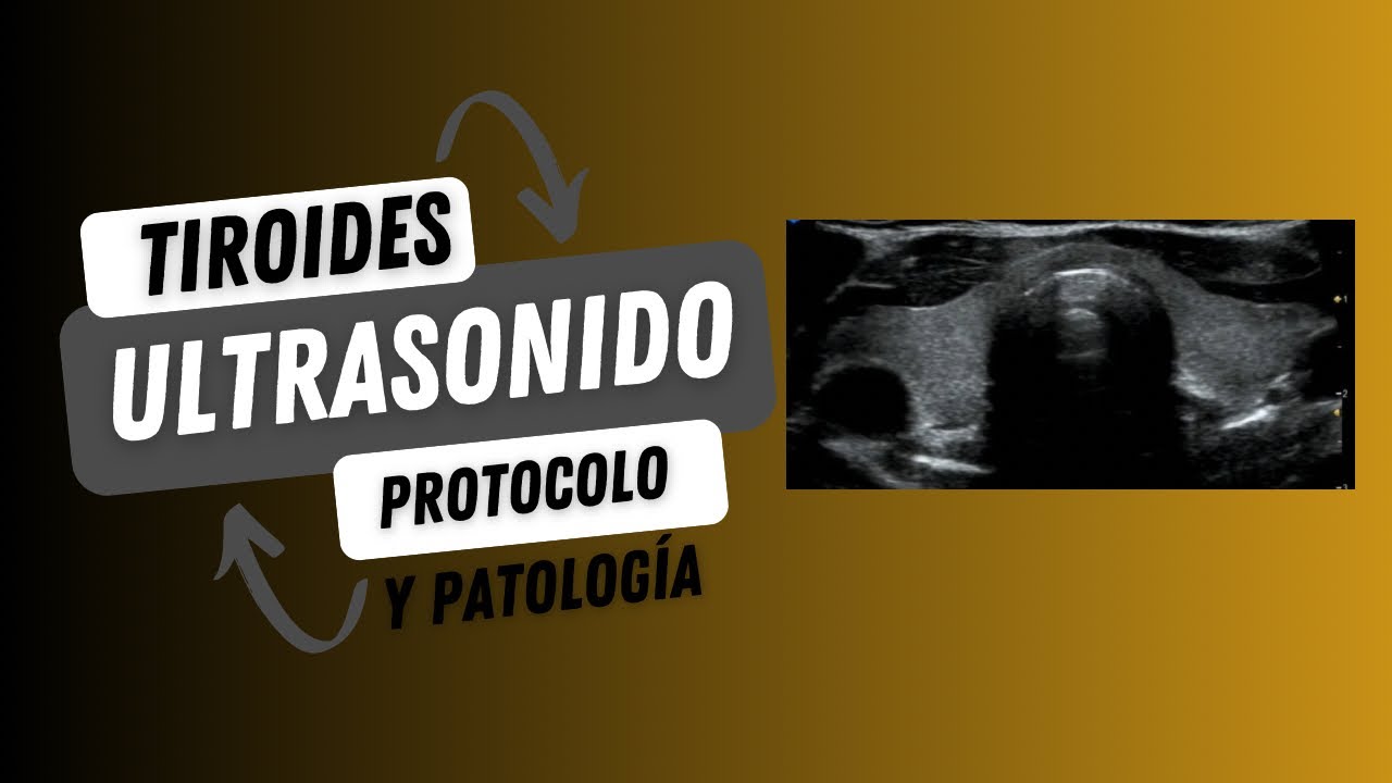 ULTRASONIDO DE TIROIDES Y NIVELES CERVICALES .- PROTOCOLO