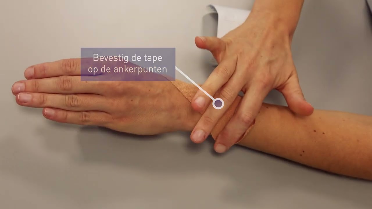 Taping duimstabilisatie