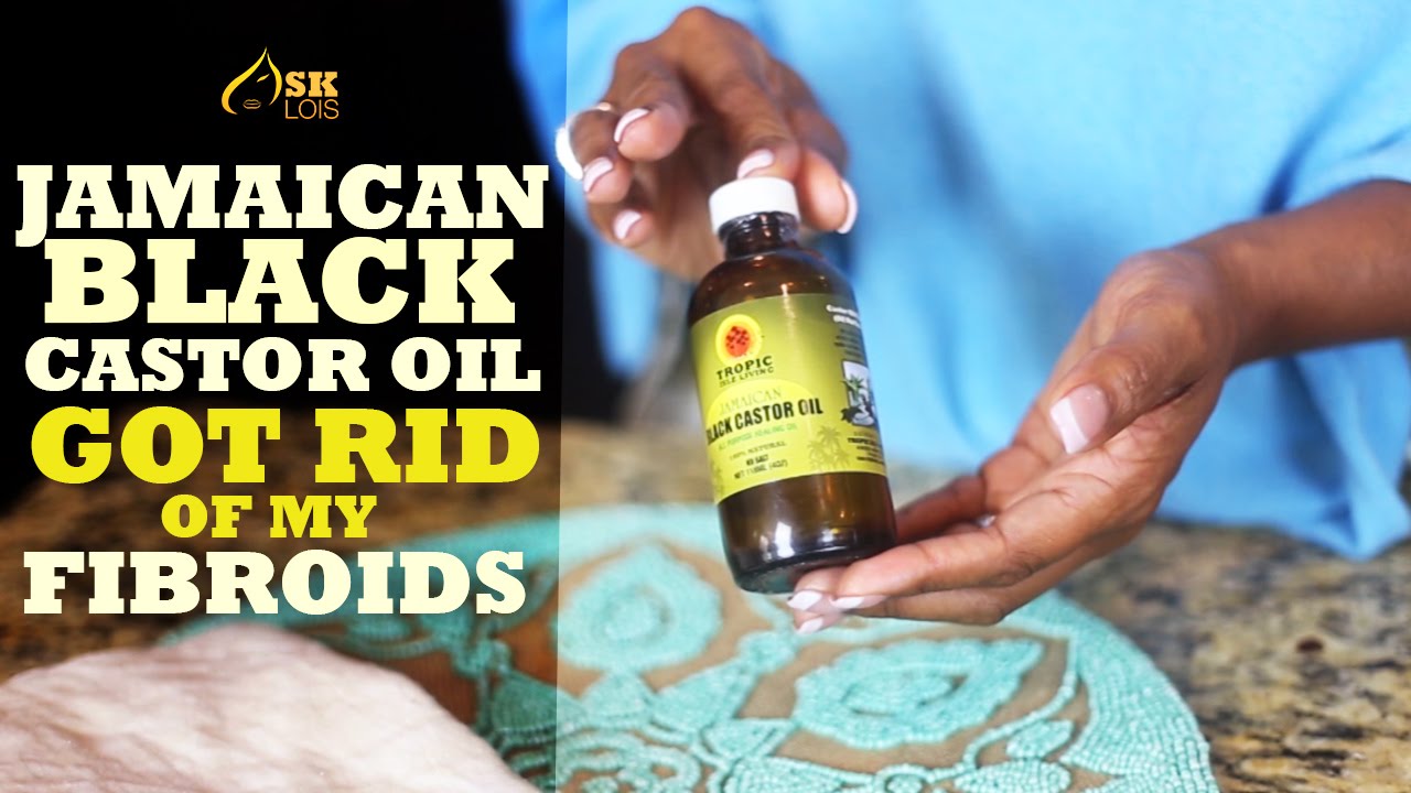 Get Rid of Fibroids with Jamaican Black Castor Oil!