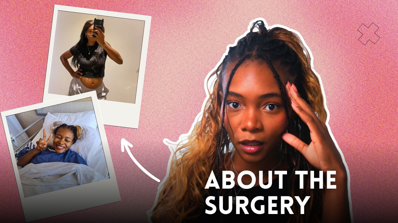 My Crazy Fibroid Surgery Story  | Open Myomectomy + recovery