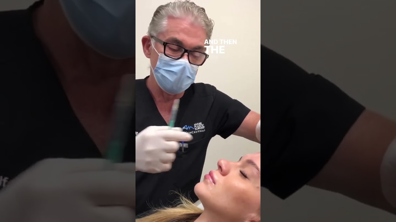 Botox Benefits and Technique Explained | Forehead Lift & Wrinkle Reduction with Dr. Carlos Wolf