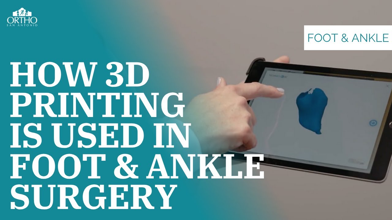 New Foot & Ankle Surgery Options #footpain