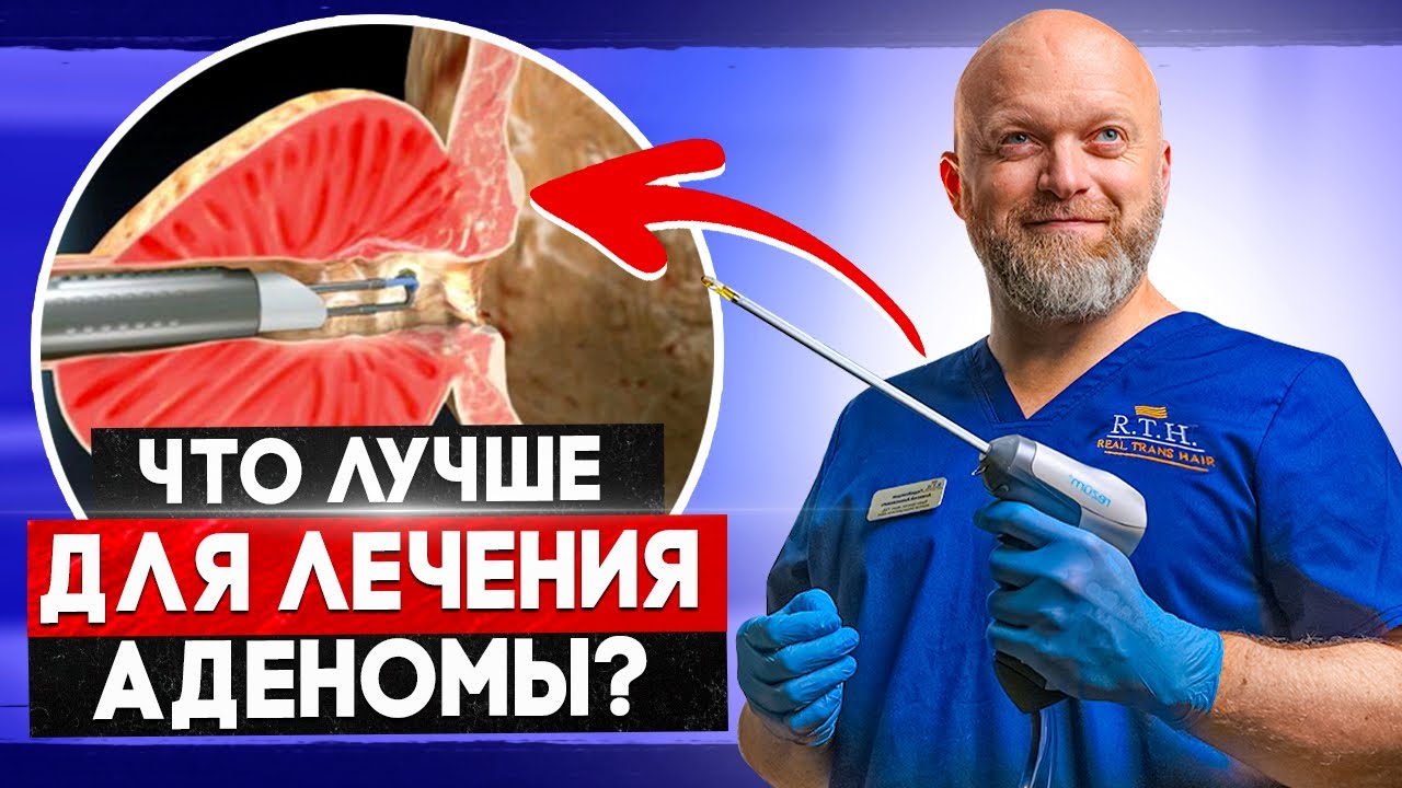 REZUM или классика? Что лучше для лечения аденомы простаты?