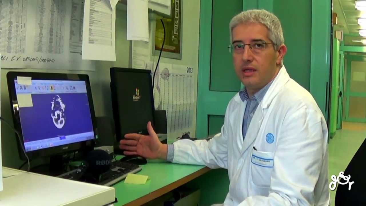 Ictus Cerebrale -  Intervento Tempestivo per la  Trombolisi nell'Ictus Ischemico