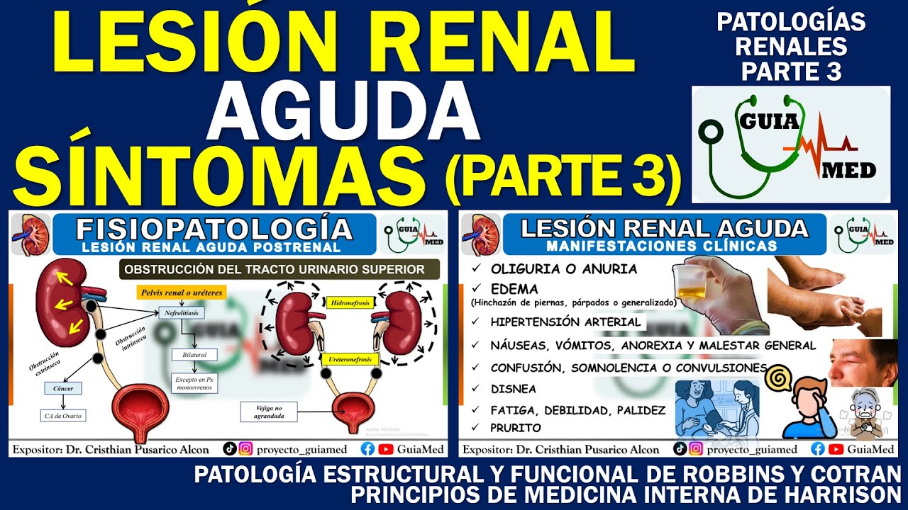 INSUFICIENCIA RENAL AGUDA SÍNTOMAS | GuiaMed