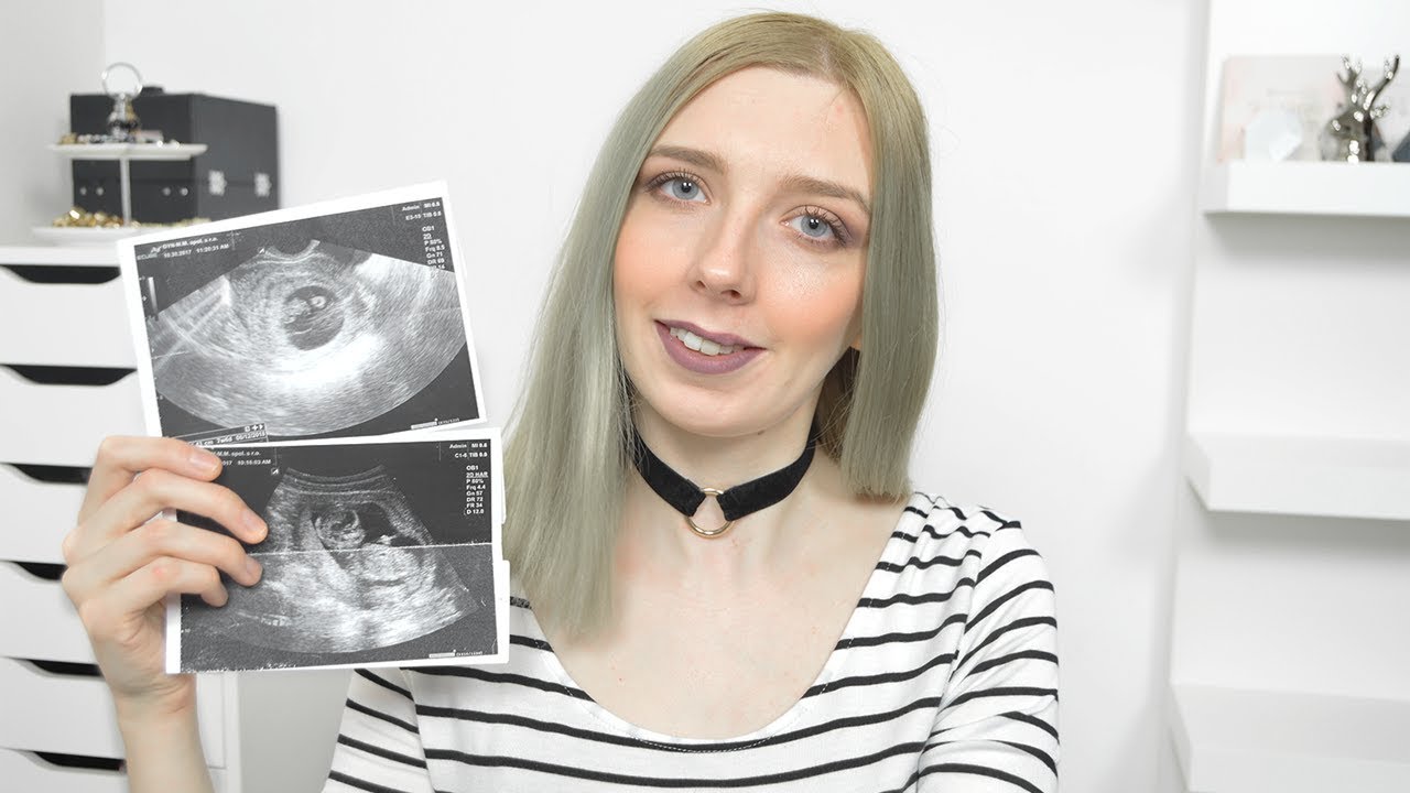 UPDATE| SOM TEHOTNÁ!