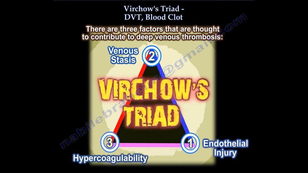 Blood clot ,DVT ,Virchow's Triad  - Everything You Need To Know - Dr. Nabil Ebraheim