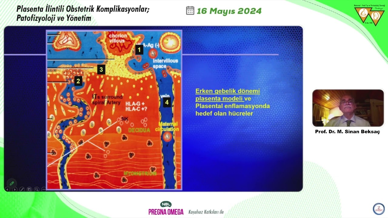 Plasenta İlintili Obstetrik Komplikasyonlar; Patofizyoloji ve Yönetim / 16 Mayıs 2024  Webinar