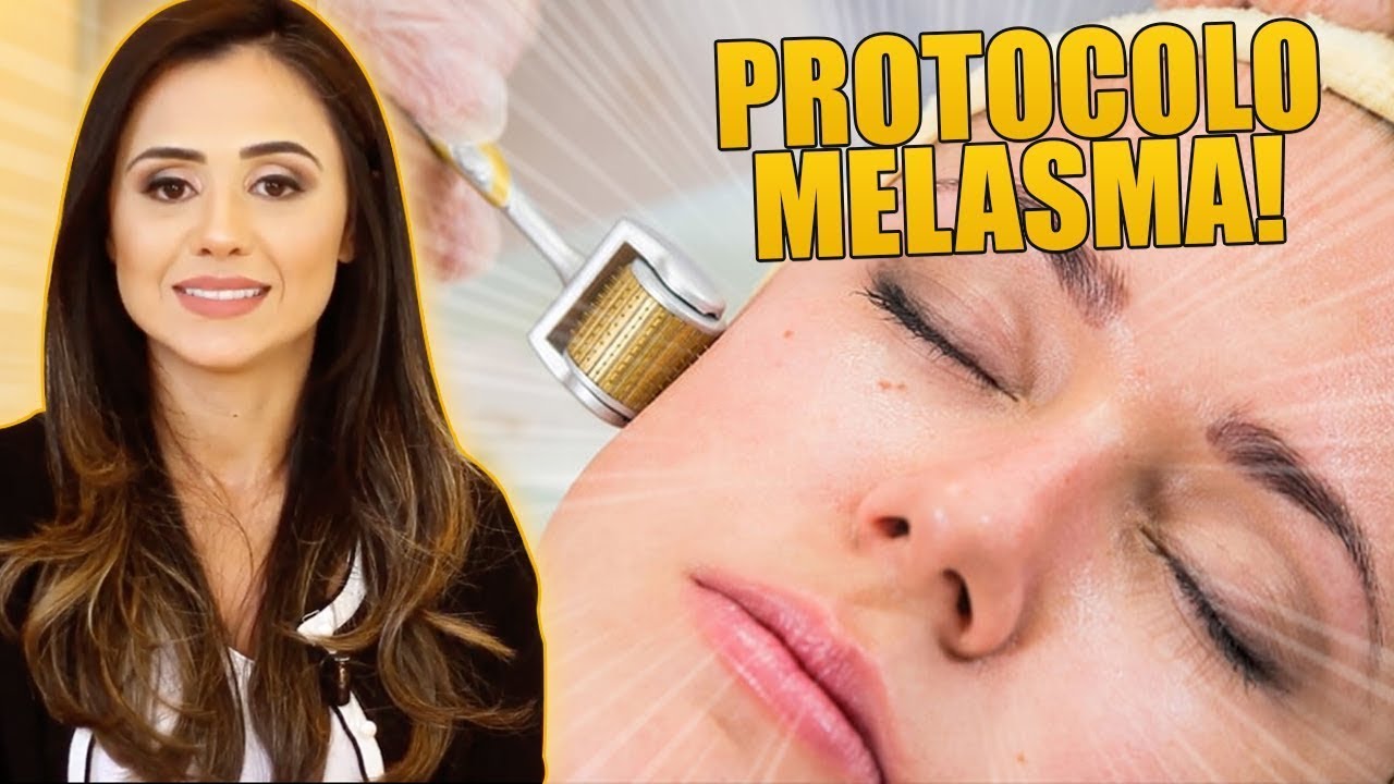 PROTOCOLO MELASMA: COMO CONSIGO TER RESULTADOS NO MICROAGULHAMENTO TRATANDO O MELASMA?