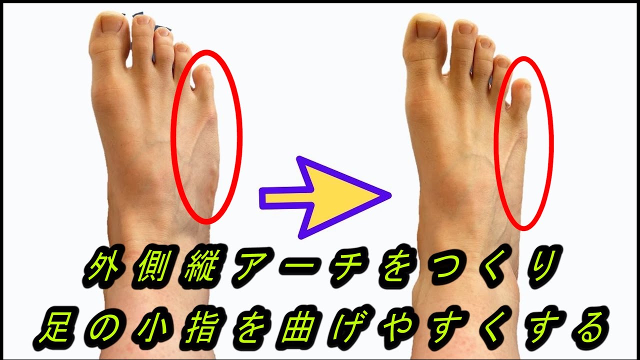 ①【足の小指を曲げる】足の外側縦アーチをつくり、足の小指を曲げやすくするセルフケア