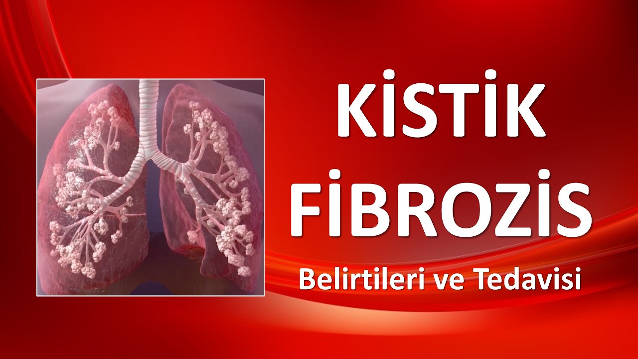 KİSTİK FİBROZİS NEDİR  NEDEN OLUR VE NASIL TEDAVİ EDİLİR?