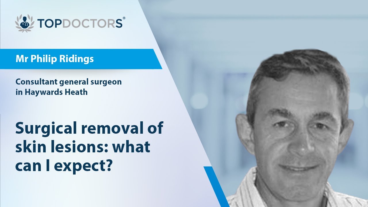 Surgical removal of skin lesions: what can I expect? - Online Interview
