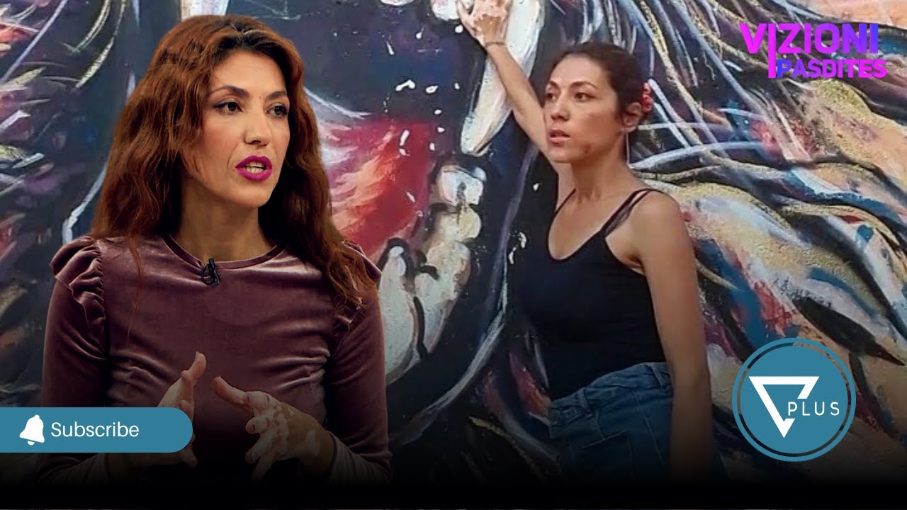 Artistja me Vitiligo rrefen sfidat: Ne fillim e pata veshtire-Vizioni i Pasdites