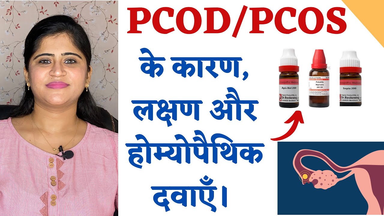 PCOD Treatment ॥ Polycystic Ovarian Syndrome के कारण , लक्षण और होम्योपैथिक दवाएँ ॥