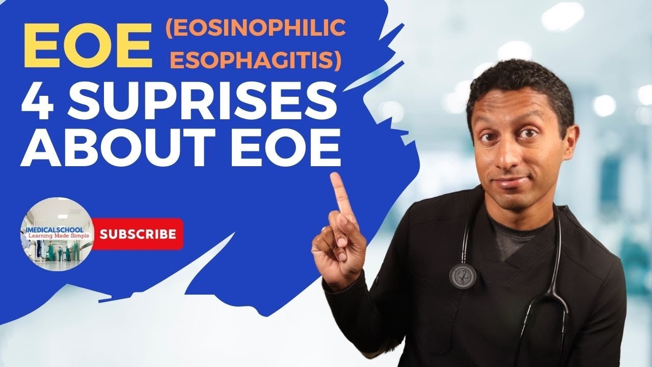 EOE (Eosinophilic Esophagitis): 4 Surprises About EOE
