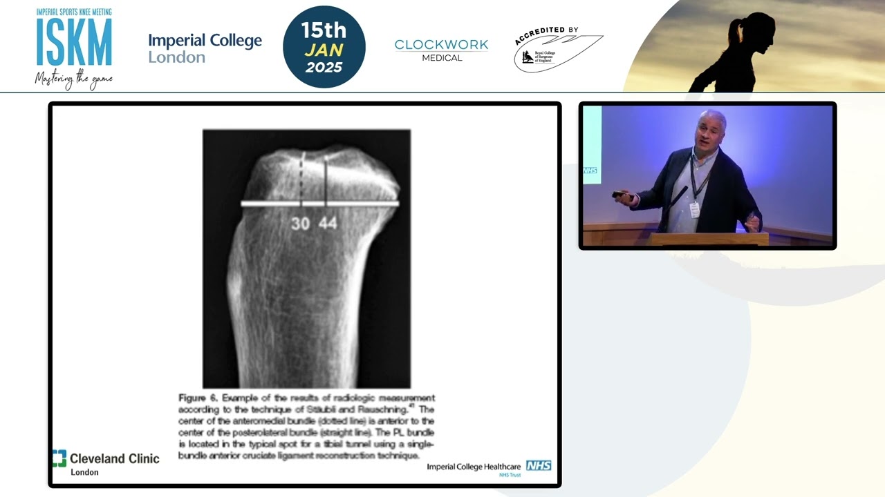ACL Reconstruction Tunnel Placement | Dinesh Nathwani