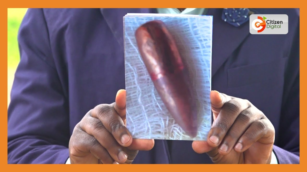 Migori woman shot, injured after attack by cattle thief posing as a police officer
