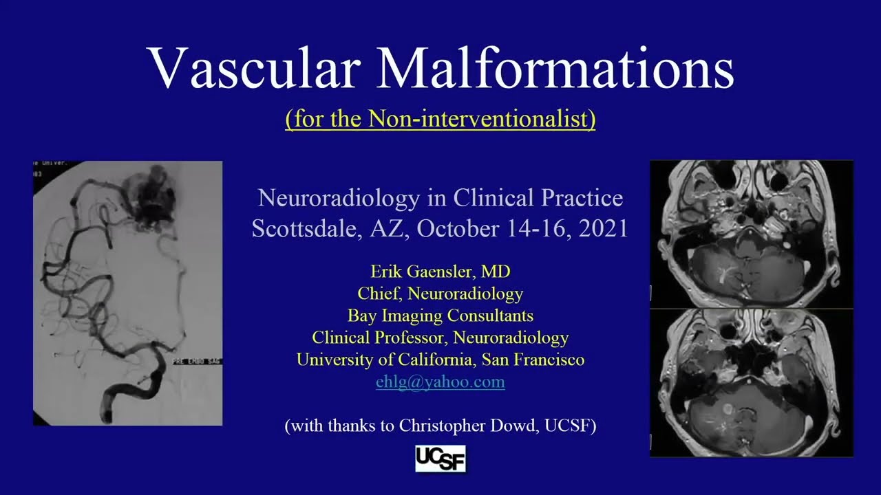 Vascular Malformations by Erik H. Gaensler, M.D.