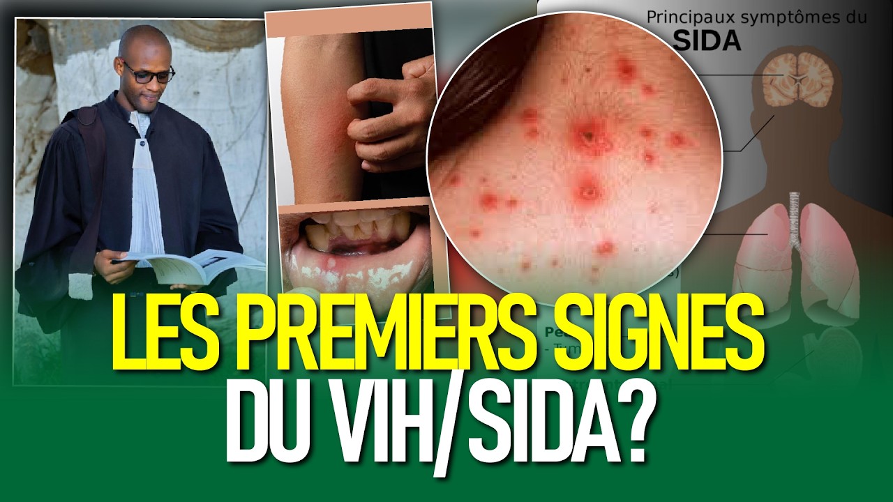 Jangoroy SIDA : Ni Febaar Bi Dougué Cà Yaram Ba Nimuy Manifesté Wo ! A à Z Avec Docteur Ndao