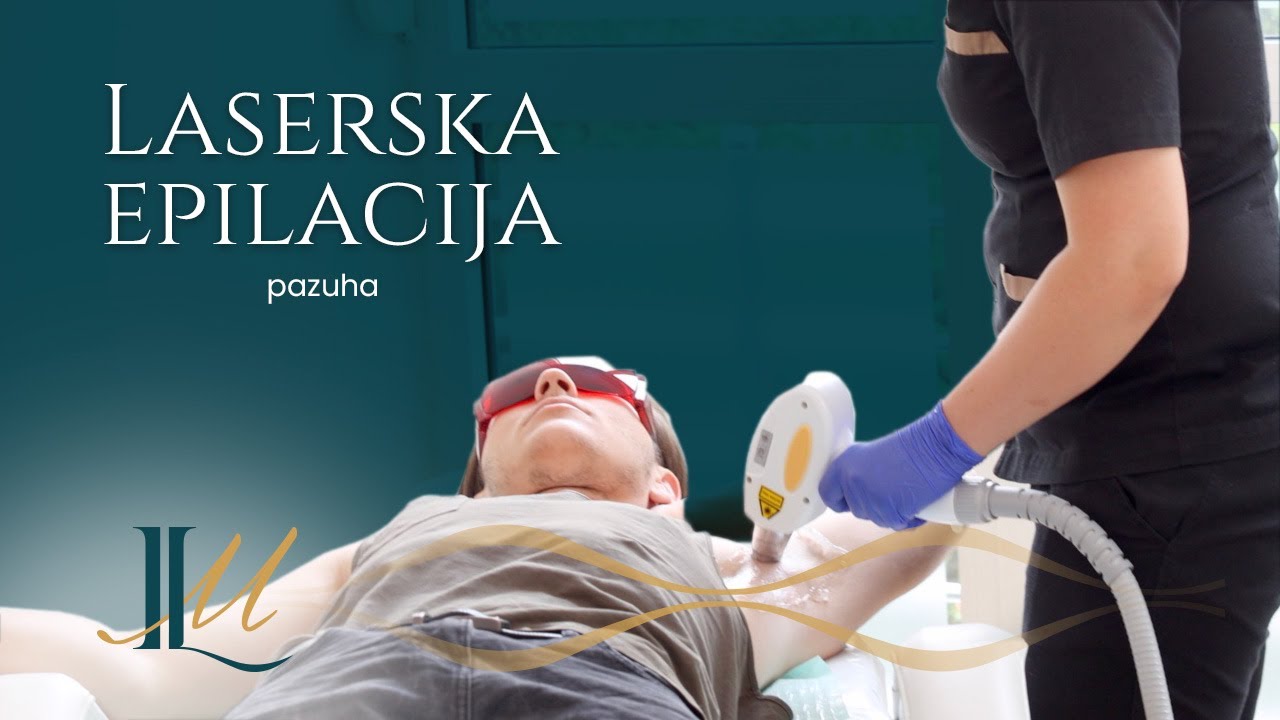 Laserska epilacija pazuha - za muškarce