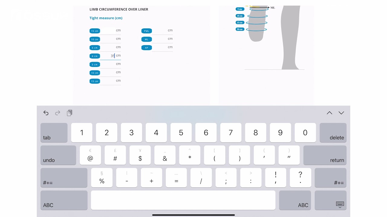 Measuring Transtibial Limb for the Össur Portal