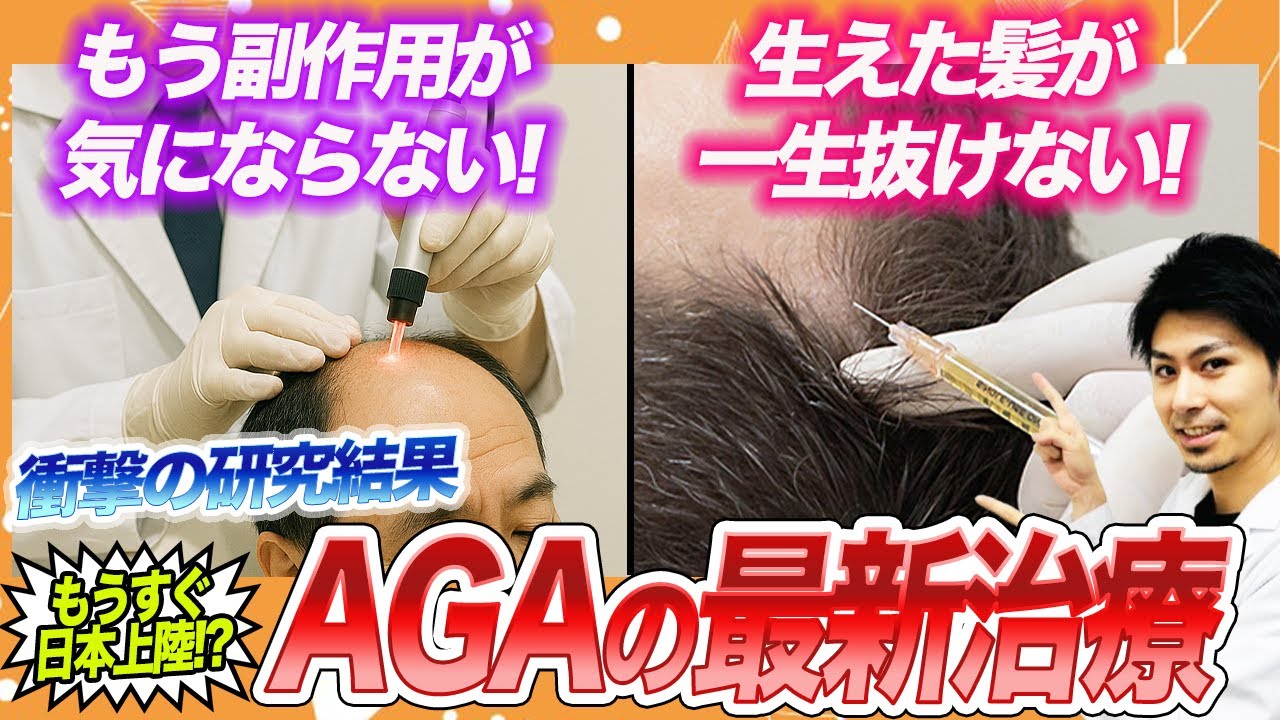 【ハゲ治療最前線】もうすぐ実現!超画期的な最新AGA治療が凄すぎる!!AGA医師が徹底解説!!
