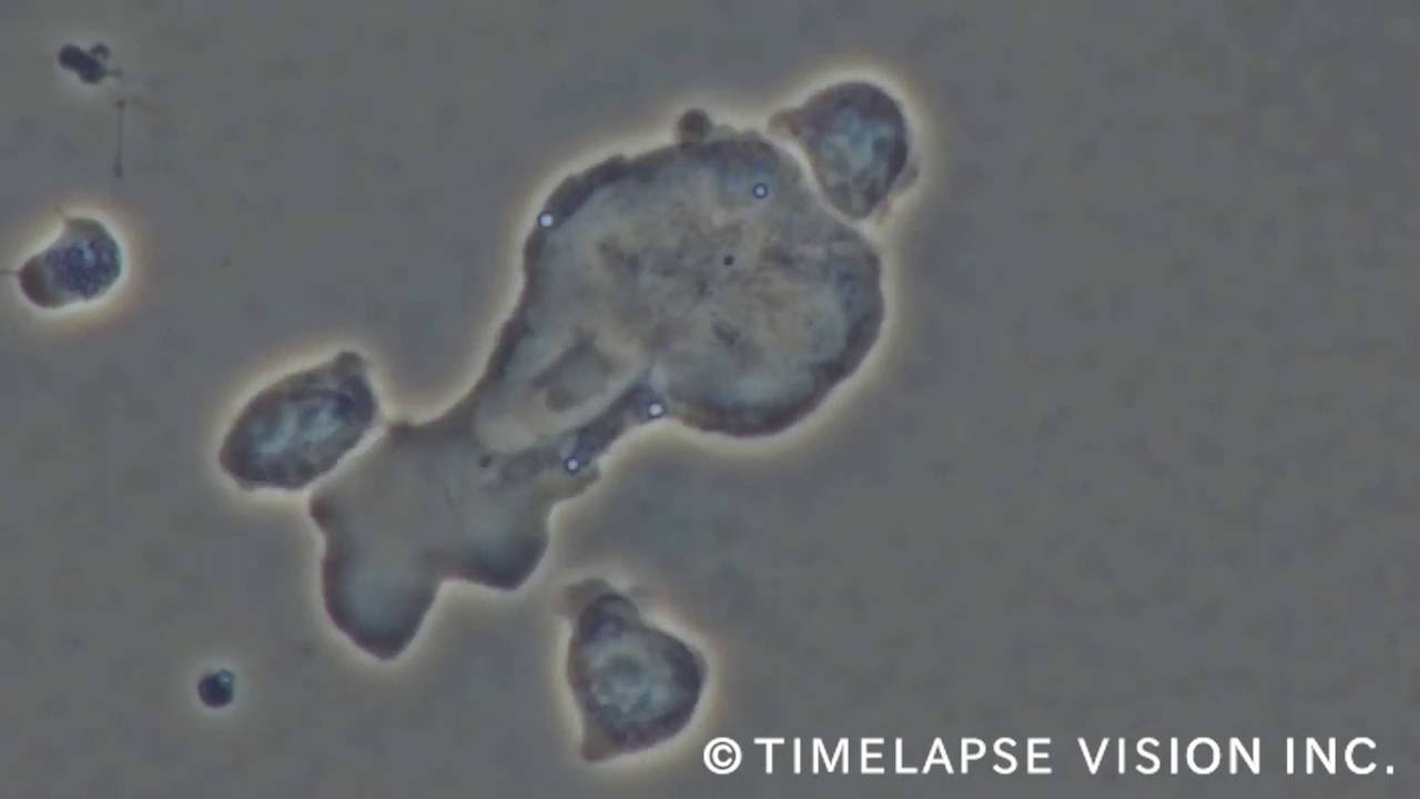 NK cells kill cancer - NK細胞ががんを殺す-