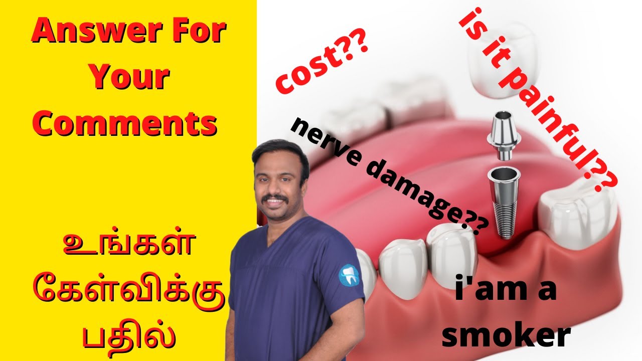 FAQ on Dental Implants 2 | Cost/ Price of Dental Implants in Chennai Madurai Coimbatore | Dr.MKP