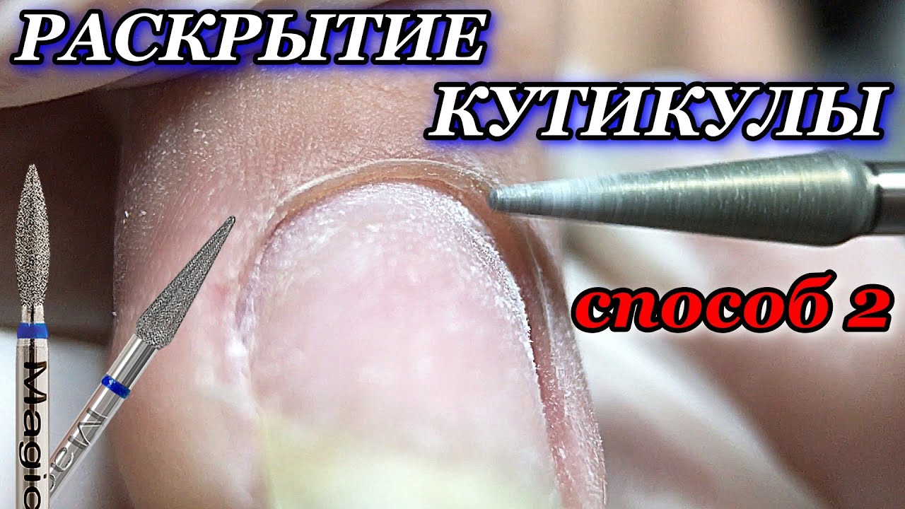 РАСКРЫТИЕ КУТИКУЛЫ ПЛАМЕНЕМ И КАПЛЕЙ