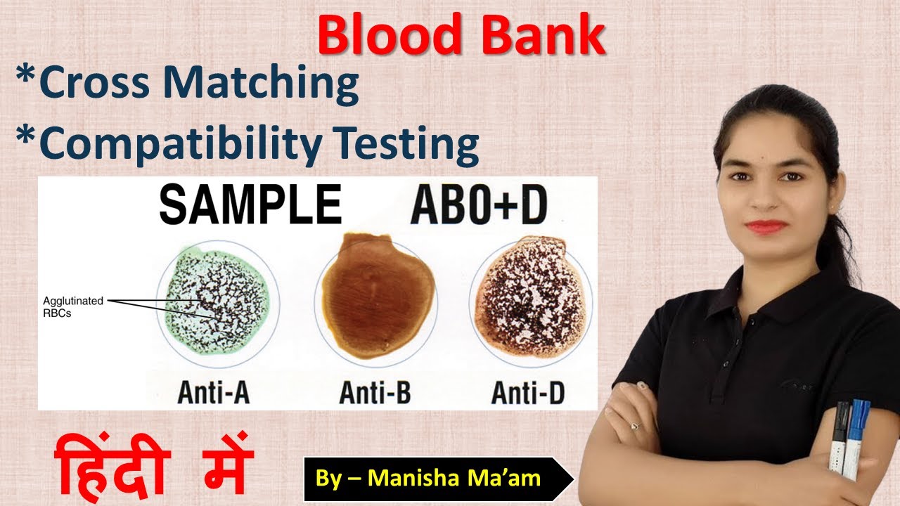 Cross Match Test in blood bank | Technique of cross matching | cross matching blood procedure