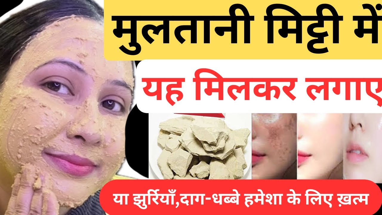 मुल्तानी मिट्टी में सिर्फ 1चीज़ मिलाकर लगालो चेहरा चमकदार होगा दागधब्बे ख़त्म/Multani mitti facepack