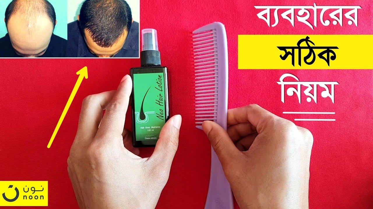 টাক থেকে চিরমুক্তি || Neo Hair Lotion Price & Details || How To Use Neo Hair Lotion || Buy From noon