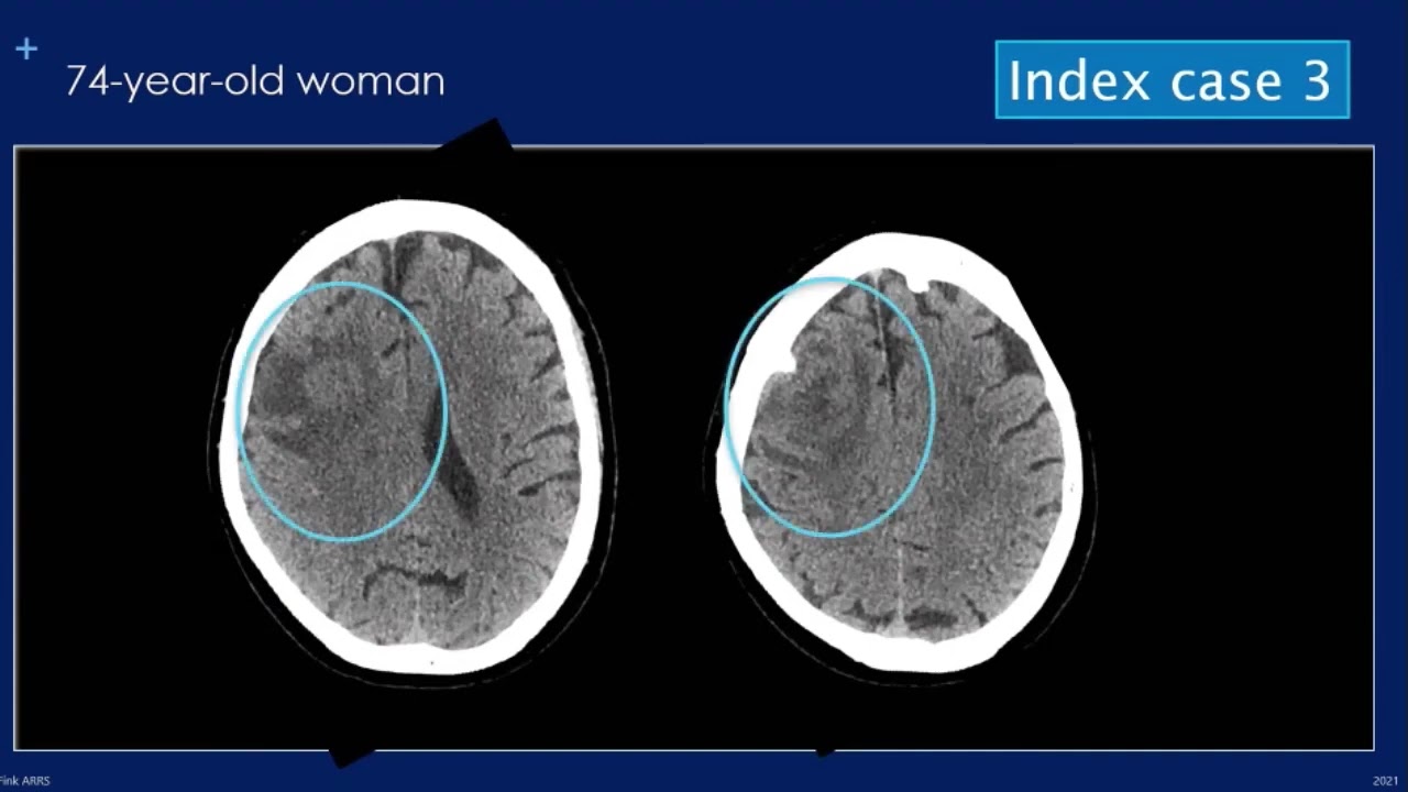 Case Review of Neuroradiology - Course Sample