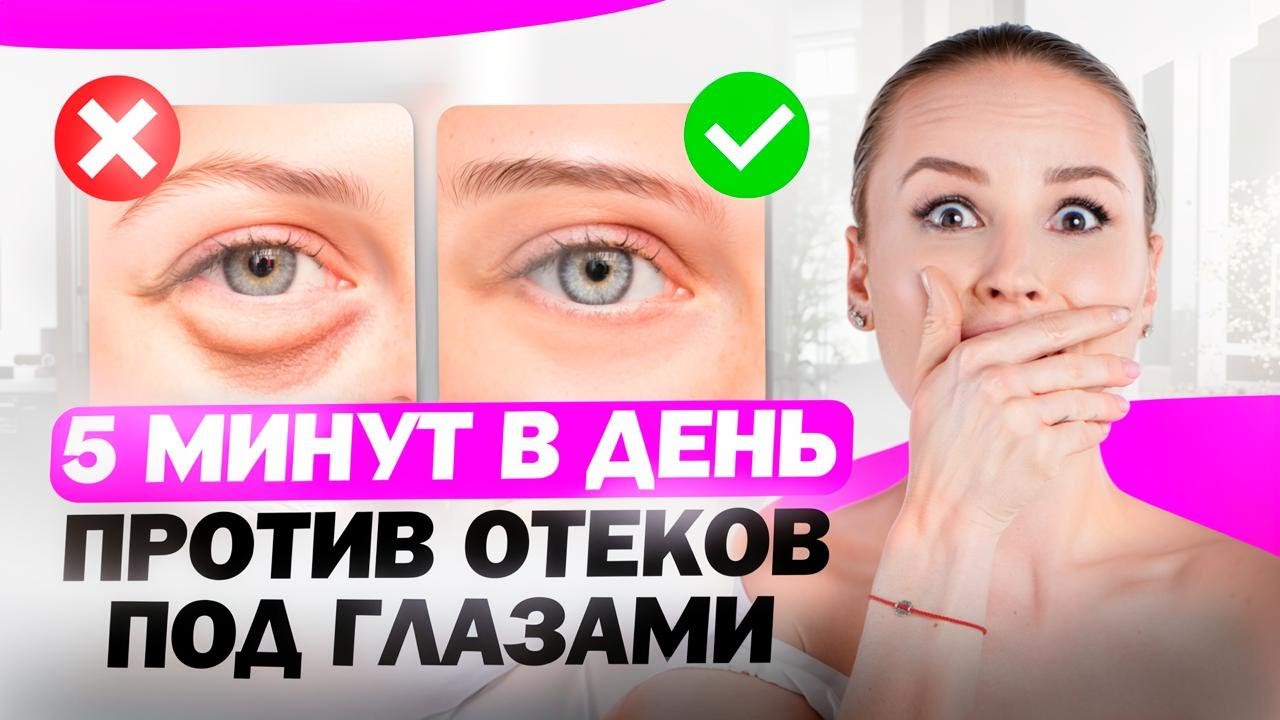 Эффективные упражнения против отечности и темных под глазами!