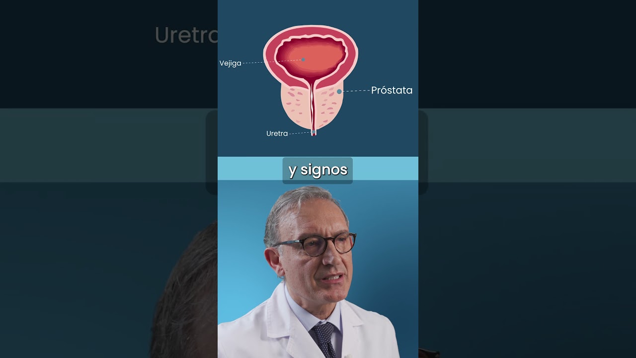 &iquest;Qu&eacute; es la hiperplasia benigna de pr&oacute;stata? Cl&iacute;nica Universidad de Navarra #prostata