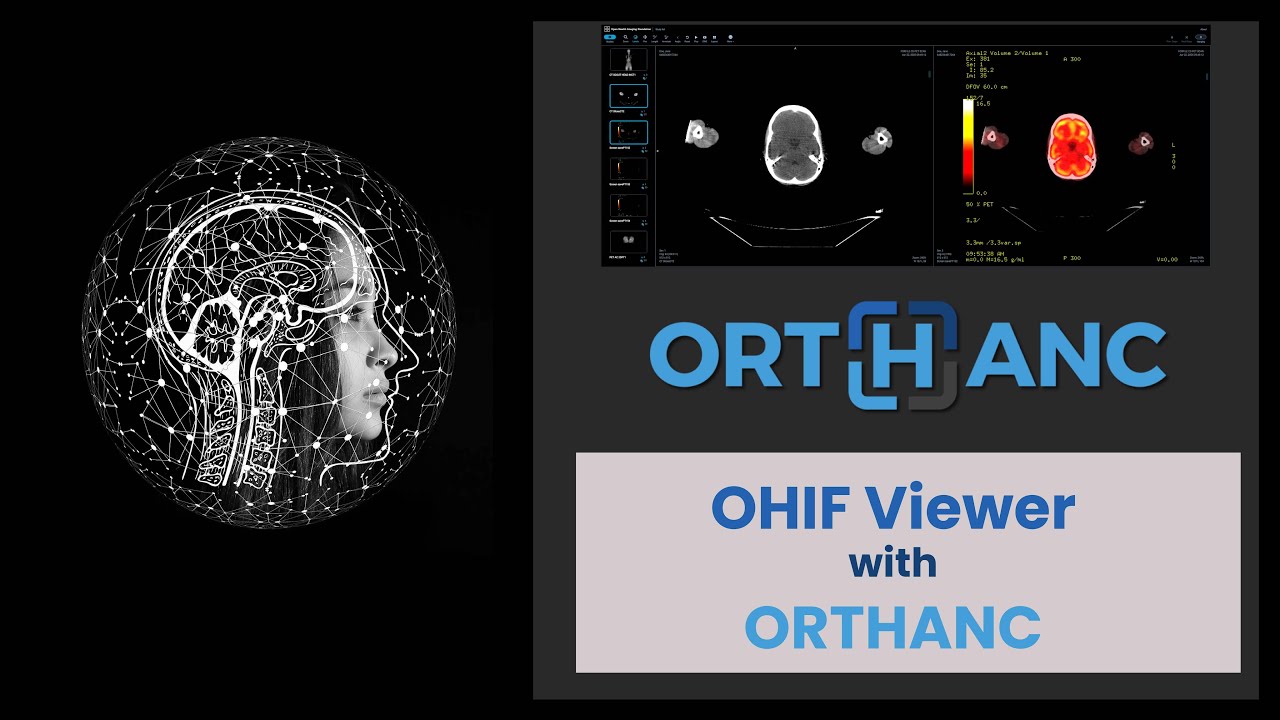 OHIF with ORTHANC DICOM Server on DOCKER for Image Sharing